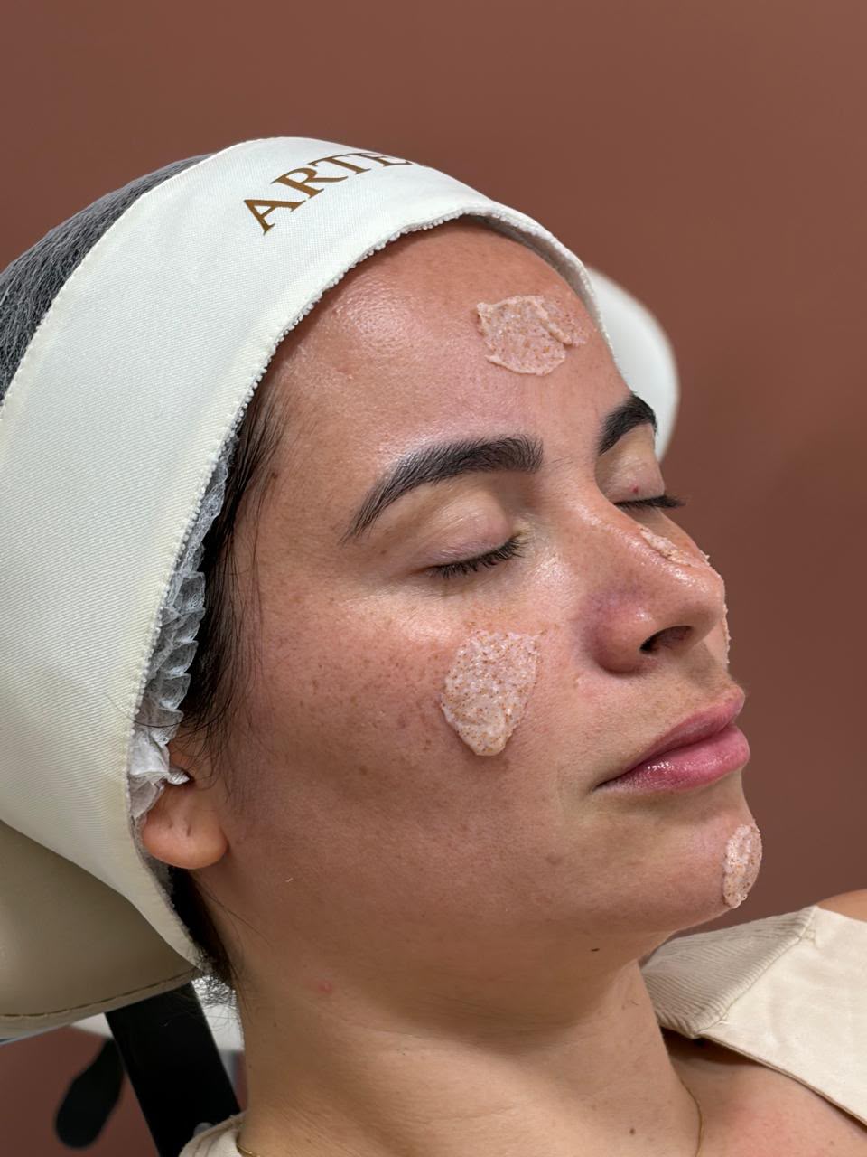 Limpeza de pele realizada na Artemisi